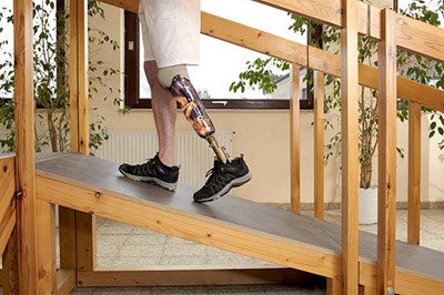 Tạo chân, tay giả dễ dàng hơn với máy scan 3D 3DeVOK